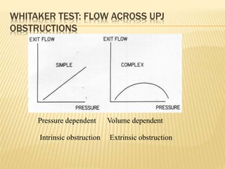 WHITAKER TEST: FLOW ACROSS UPJ
OBSTRUCTIONS
Pressure dependent Volume dependent
Intrinsic obstruction Extrinsic obstruction
 