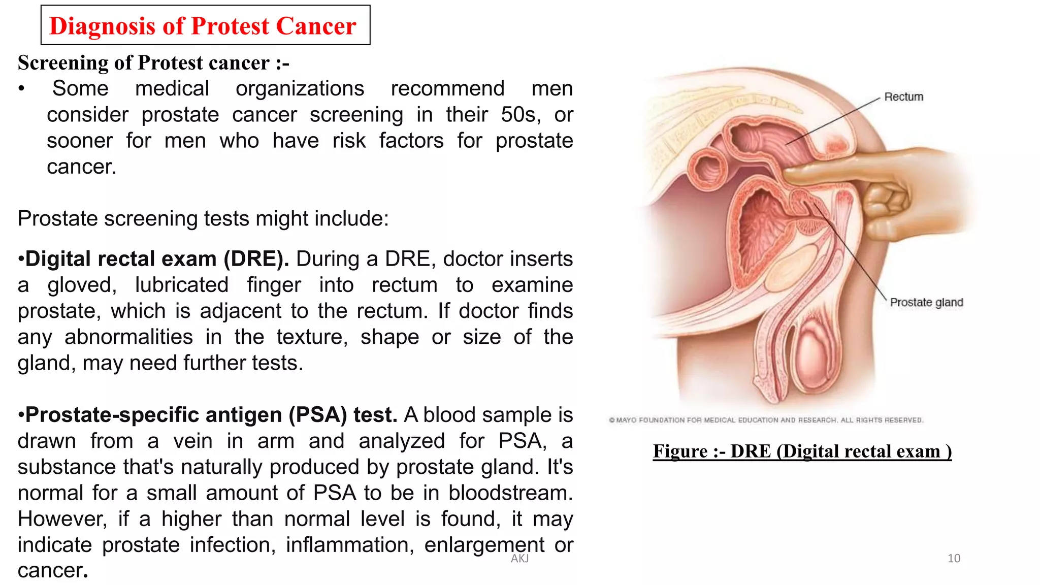 Diagnosis of Protest Cancer
Screening of Protest cancer :-
• Some medical organizations recommend men
consider prostate cancer screening in their 50s, or
sooner for men who have risk factors for prostate
cancer.
Prostate screening tests might include:
•Digital rectal exam (DRE). During a DRE, doctor inserts
a gloved, lubricated finger into rectum to examine
prostate, which is adjacent to the rectum. If doctor finds
any abnormalities in the texture, shape or size of the
gland, may need further tests.
•Prostate-specific antigen (PSA) test. A blood sample is
drawn from a vein in arm and analyzed for PSA, a
substance that's naturally produced by prostate gland. It's
normal for a small amount of PSA to be in bloodstream.
However, if a higher than normal level is found, it may
indicate prostate infection, inflammation, enlargement or
cancer.
Figure :- DRE (Digital rectal exam )
AKJ 10
 