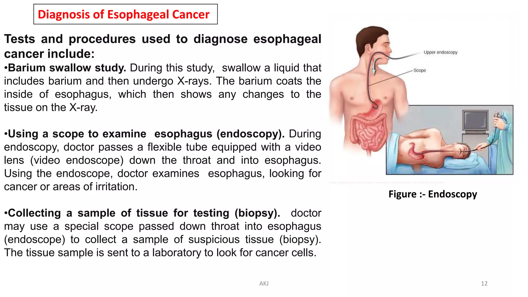 Diagnosis of Esophageal Cancer
Tests and procedures used to diagnose esophageal
cancer include:
•Barium swallow study. During this study, swallow a liquid that
includes barium and then undergo X-rays. The barium coats the
inside of esophagus, which then shows any changes to the
tissue on the X-ray.
•Using a scope to examine esophagus (endoscopy). During
endoscopy, doctor passes a flexible tube equipped with a video
lens (video endoscope) down the throat and into esophagus.
Using the endoscope, doctor examines esophagus, looking for
cancer or areas of irritation.
•Collecting a sample of tissue for testing (biopsy). doctor
may use a special scope passed down throat into esophagus
(endoscope) to collect a sample of suspicious tissue (biopsy).
The tissue sample is sent to a laboratory to look for cancer cells.
Figure :- Endoscopy
AKJ 12
 