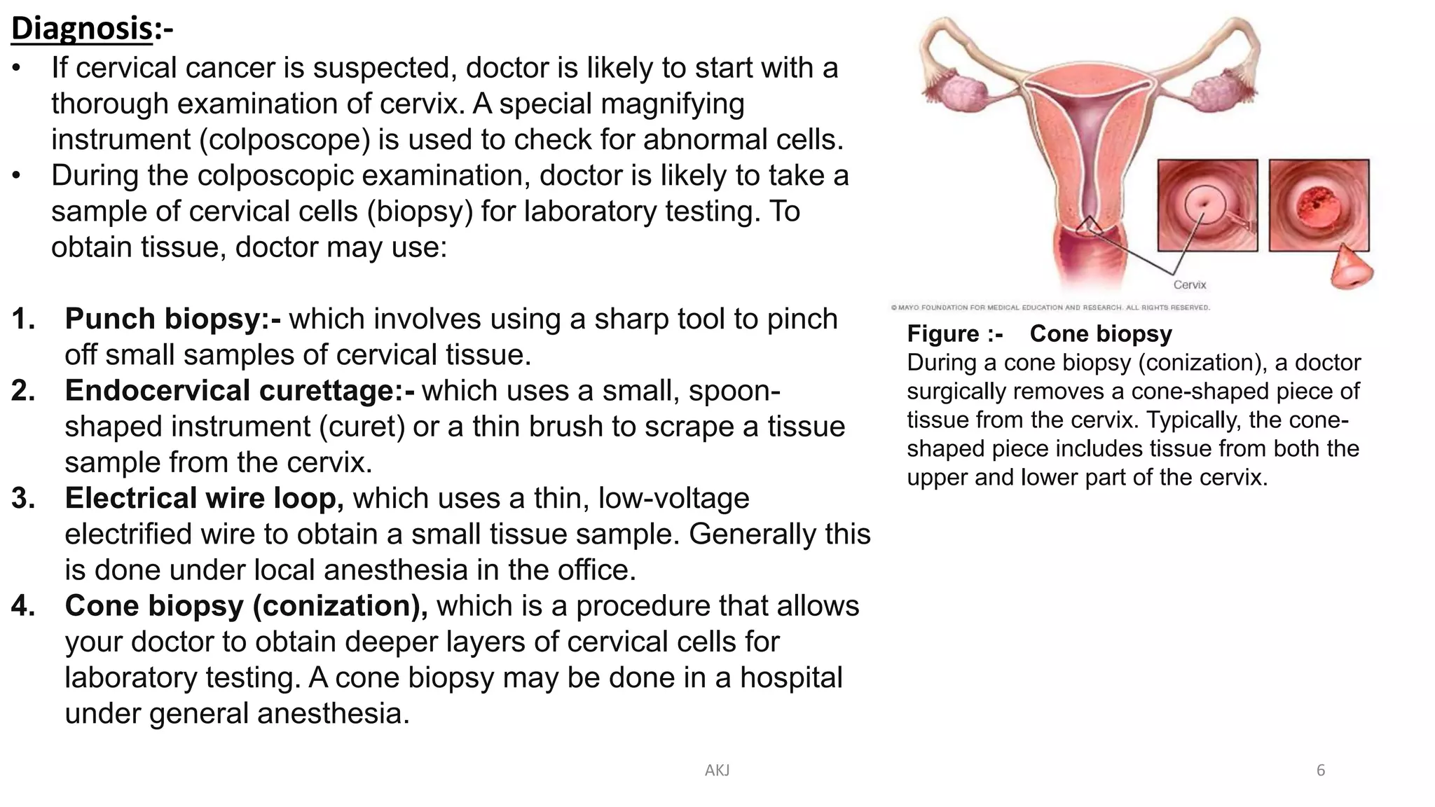 Diagnosis:-
• If cervical cancer is suspected, doctor is likely to start with a
thorough examination of cervix. A special magnifying
instrument (colposcope) is used to check for abnormal cells.
• During the colposcopic examination, doctor is likely to take a
sample of cervical cells (biopsy) for laboratory testing. To
obtain tissue, doctor may use:
1. Punch biopsy:- which involves using a sharp tool to pinch
off small samples of cervical tissue.
2. Endocervical curettage:- which uses a small, spoon-
shaped instrument (curet) or a thin brush to scrape a tissue
sample from the cervix.
3. Electrical wire loop, which uses a thin, low-voltage
electrified wire to obtain a small tissue sample. Generally this
is done under local anesthesia in the office.
4. Cone biopsy (conization), which is a procedure that allows
your doctor to obtain deeper layers of cervical cells for
laboratory testing. A cone biopsy may be done in a hospital
under general anesthesia.
Figure :- Cone biopsy
During a cone biopsy (conization), a doctor
surgically removes a cone-shaped piece of
tissue from the cervix. Typically, the cone-
shaped piece includes tissue from both the
upper and lower part of the cervix.
AKJ 6
 