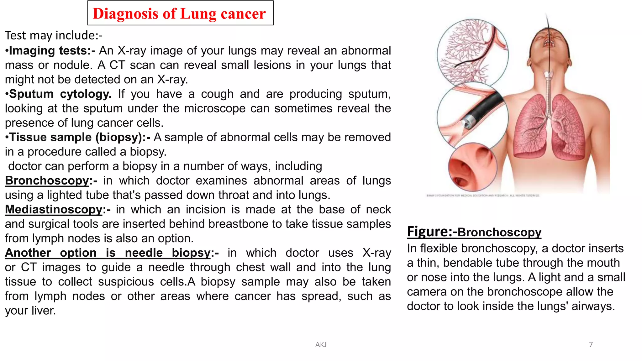 Diagnosis of Lung cancer
Test may include:-
•Imaging tests:- An X-ray image of your lungs may reveal an abnormal
mass or nodule. A CT scan can reveal small lesions in your lungs that
might not be detected on an X-ray.
•Sputum cytology. If you have a cough and are producing sputum,
looking at the sputum under the microscope can sometimes reveal the
presence of lung cancer cells.
•Tissue sample (biopsy):- A sample of abnormal cells may be removed
in a procedure called a biopsy.
doctor can perform a biopsy in a number of ways, including
Bronchoscopy:- in which doctor examines abnormal areas of lungs
using a lighted tube that's passed down throat and into lungs.
Mediastinoscopy:- in which an incision is made at the base of neck
and surgical tools are inserted behind breastbone to take tissue samples
from lymph nodes is also an option.
Another option is needle biopsy:- in which doctor uses X-ray
or CT images to guide a needle through chest wall and into the lung
tissue to collect suspicious cells.A biopsy sample may also be taken
from lymph nodes or other areas where cancer has spread, such as
your liver.
Figure:-Bronchoscopy
In flexible bronchoscopy, a doctor inserts
a thin, bendable tube through the mouth
or nose into the lungs. A light and a small
camera on the bronchoscope allow the
doctor to look inside the lungs' airways.
AKJ 7
 