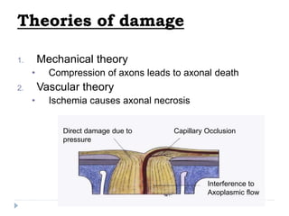 Theories of damage
1. Mechanical theory
• Compression of axons leads to axonal death
2. Vascular theory
• Ischemia causes axonal necrosis
Direct damage due to
pressure
Capillary Occlusion
Interference to
Axoplasmic flow
 