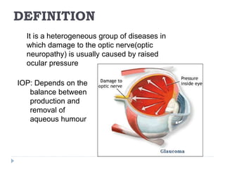DEFINITION
It is a heterogeneous group of diseases in
which damage to the optic nerve(optic
neuropathy) is usually caused by raised
ocular pressure
IOP: Depends on the
balance between
production and
removal of
aqueous humour
 