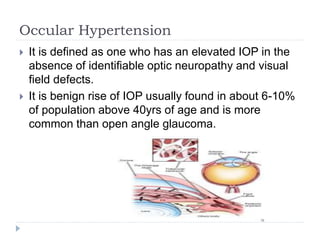 Occular Hypertension
 It is defined as one who has an elevated IOP in the
absence of identifiable optic neuropathy and visual
field defects.
 It is benign rise of IOP usually found in about 6-10%
of population above 40yrs of age and is more
common than open angle glaucoma.
 