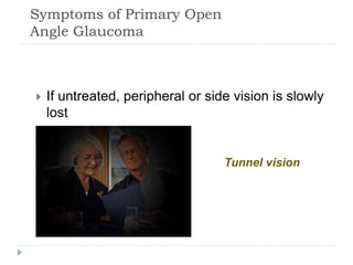 Symptoms of Primary Open
Angle Glaucoma
 If untreated, peripheral or side vision is slowly
lost
Tunnel vision
 