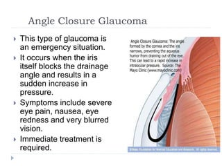 Angle Closure Glaucoma
 This type of glaucoma is
an emergency situation.
 It occurs when the iris
itself blocks the drainage
angle and results in a
sudden increase in
pressure.
 Symptoms include severe
eye pain, nausea, eye
redness and very blurred
vision.
 Immediate treatment is
required.
 