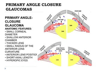 PRIMARY ANGLE CLOSURE
GLAUCOMAS
PRIMARY ANGLE-
CLOSURE
GLAUCOMA
ANATOMIC FEATURES:
• SMALL CORNEAL
DIAMETER
• SHALLOW ANTERIOR
CHAMBER
• THICKER LENS
• SMALL RADIUS OF THE
ANTERIOR LENS
CURVATURE
• ANTERIOR LENS POSITION
• SHORT AXIAL LENGTH
• HYPEROPIC EYES
 