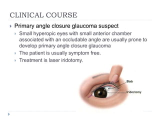 CLINICAL COURSE
 Primary angle closure glaucoma suspect
 Small hyperopic eyes with small anterior chamber
associated with an occludable angle are usually prone to
develop primary angle closure glaucoma
 The patient is usually symptom free.
 Treatment is laser iridotomy.
 
