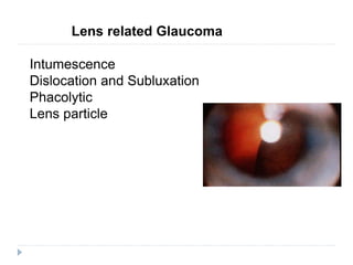 Lens related Glaucoma
Intumescence
Dislocation and Subluxation
Phacolytic
Lens particle
 