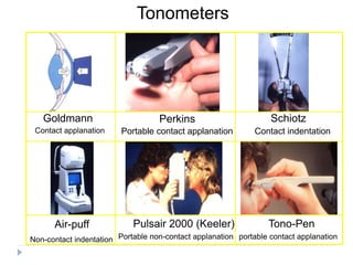 Tonometers
Goldmann
Contact applanation
Perkins
Portable contact applanation
Pulsair 2000 (Keeler)Air-puff
Schiotz
Portable non-contact applanationNon-contact indentation
Contact indentation
Tono-Pen
portable contact applanation
 