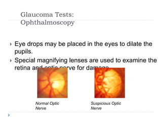 Glaucoma Tests:
Ophthalmoscopy
 Eye drops may be placed in the eyes to dilate the
pupils.
 Special magnifying lenses are used to examine the
retina and optic nerve for damage.
Normal Optic
Nerve
Suspicious Optic
Nerve
 