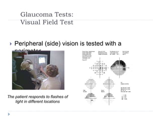 Glaucoma Tests:
Visual Field Test
 Peripheral (side) vision is tested with a
perimeter.
The patient responds to flashes of
light in different locations
 