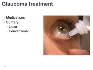 Glaucoma treatment
 Medications
 Surgery
◦ Laser
◦ Conventional
 