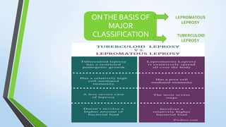 ONTHE BASIS OF
MAJOR
CLASSIFICATION
LEPROMATOUS
LEPROSY
TUBERCULOID
LEPROSY
 