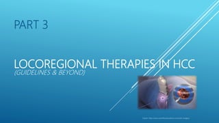 PART 3
LOCOREGIONAL THERAPIES IN HCC
(GUIDELINES & BEYOND)
Clipart :http://www.scientificanimations.com/wiki-images/
 