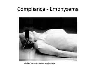 Compliance - Emphysema