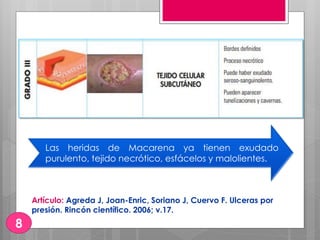 Las heridas de Macarena ya tienen exudado
purulento, tejido necrótico, esfácelos y malolientes.
Artículo: Agreda J, Joan-Enric, Soriano J, Cuervo F. Ulceras por
presión. Rincón científico. 2006; v.17.
8
 