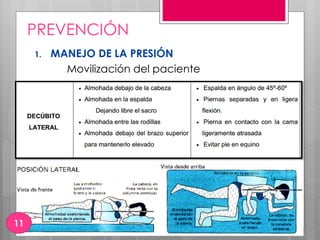 PREVENCIÓN
1. MANEJO DE LA PRESIÓN
Movilización del paciente
11
 