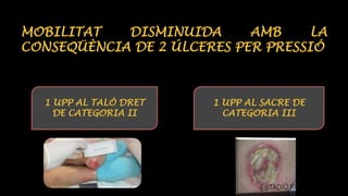 MOBILITAT DISMINUIDA AMB LA 
CONSEQÜÈNCIA DE 2 ÚLCERES PER PRESSIÓ 
1 UPP AL TALÓ DRET 
DE CATEGORIA II 
1 UPP AL SACRE DE 
CATEGORIA III 
 