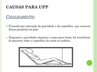 CAUSAS PARA UPP
CISALHAMENTO
 Causado por interação da gravidade e da superfície, que exercem
forças paralelas na pele.
 Enquanto a gravidade empurra o corpo para baixo, há resistência
do paciente sobre a superfície da cama ou cadeira.
 