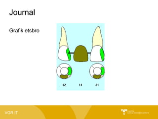 Journal
Grafik etsbro

VGR IT

 