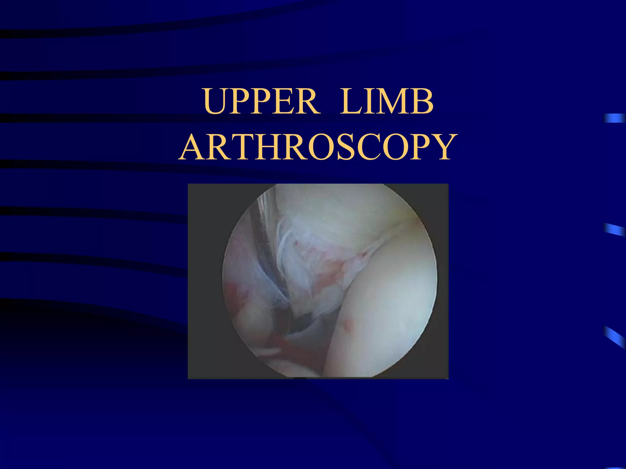 UPPER LIMB ARTHROSCOPY