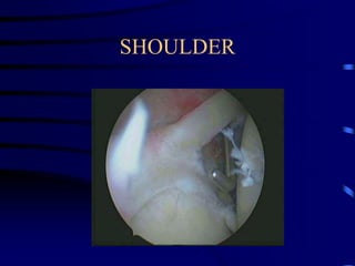 SHOULDER