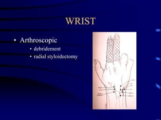 WRISTArthroscopicdebridementradial styloidectomy
