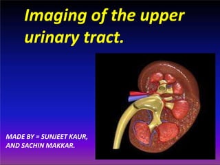 Imaging of the upper
urinary tract.
MADE BY = SUNJEET KAUR,
AND SACHIN MAKKAR.
 