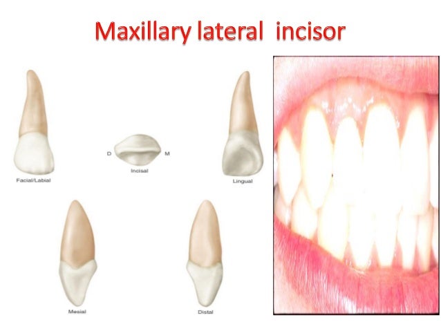 upper lateral incisor central incisor