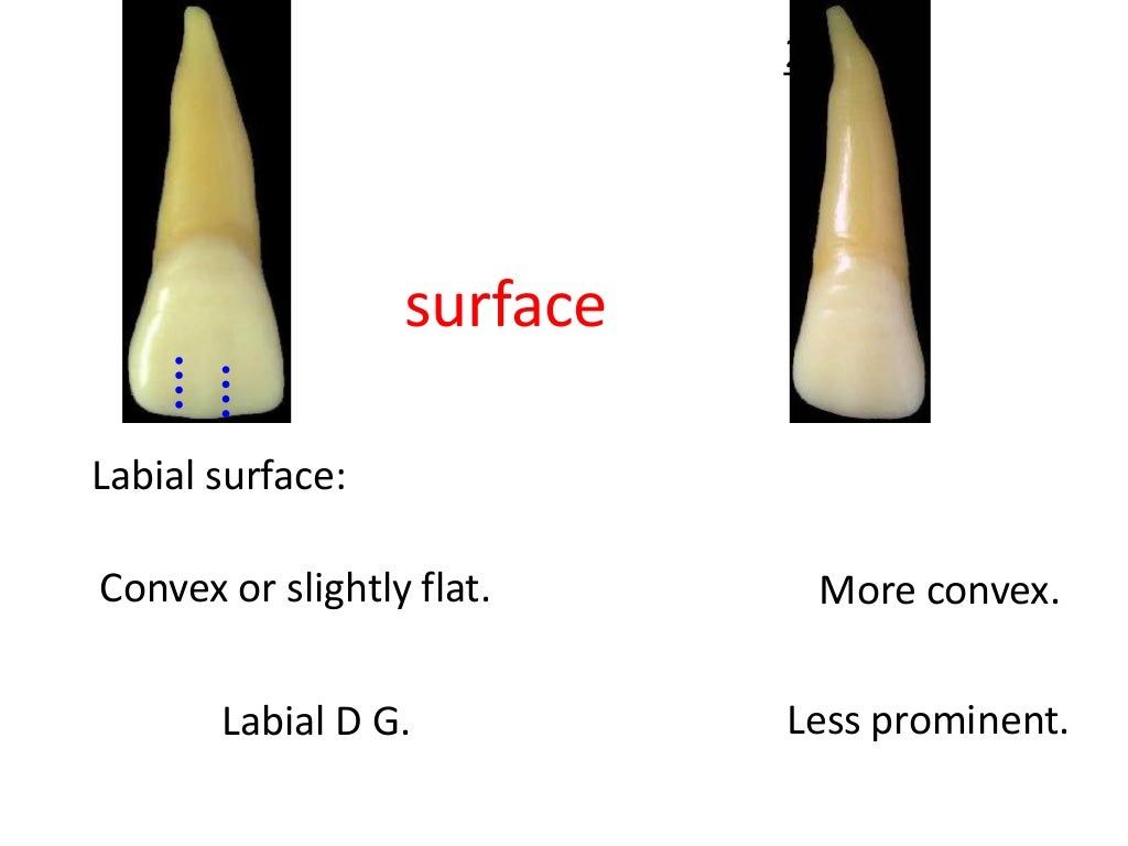 Upper Lateral Incisors