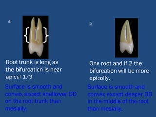 Root trunk is long as
the bifurcation is near
apical 1/3
Surface is smooth and
convex except shallower DD
on the root trunk than
mesially.
5
4
One root and if 2 the
bifurcation will be more
apically.
Surface is smooth and
convex except deeper DD
in the middle of the root
than mesially.
 