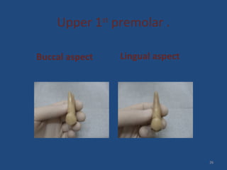 Upper 1st
premolar .
Buccal aspect Lingual aspect
26
 