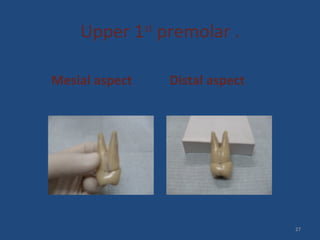 Upper 1st
premolar .
Mesial aspect Distal aspect
27
 