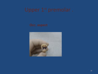 Upper 1st
premolar .
Occ. aspect
28
 