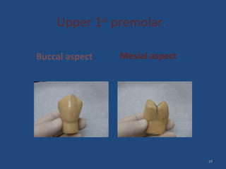 Upper 1st
premolar .
Buccal aspect Mesial aspect
29
 