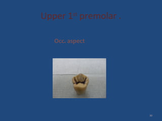 Upper 1st
premolar .
Occ. aspect
30
 
