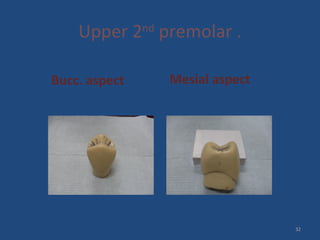 Upper 2nd
premolar .
Bucc. aspect Mesial aspect
32
 