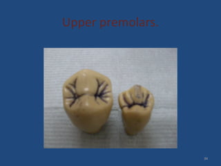 Upper premolars.
34
 