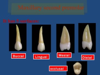 Maxillary second premolar
It has 5 surfaces:
Buccal Lingual Mesial
Distal
occlusal
 