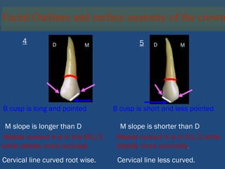 Facial Outlines and surface anatomy of the crown
4 5
B cusp is long and pointed B cusp is short and less pointed
M slope is longer than D M slope is shorter than D
Mesial contact A is in the M1/3
while distally more occlusal.
Mesial contact A is in O1/3 while
distally more cervically.
M
D D M
Cervical line curved root wise. Cervical line less curved.
 