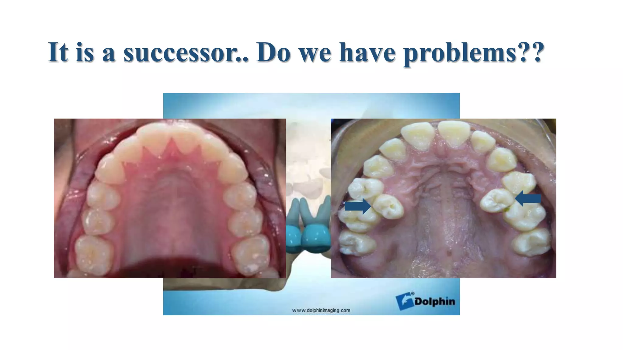 It is a successor.. Do we have problems??
 