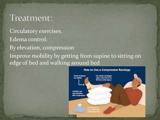 Circulatory exercises.
Edema control:
By elevation, compression
Improve mobility by getting from supine to sitting on
edge of bed and walking around bed
 