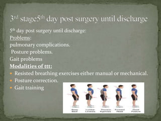 5th day post surgery until discharge:
Problems:
pulmonary complications.
Posture problems.
Gait problems
Modalities of ttt:
 Resisted breathing exercises either manual or mechanical.
 Posture correction.
 Gait training
 