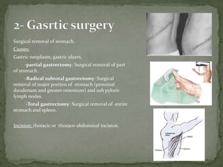 Surgical removal of stomach.
Causes:
Gastric neoplasm, gastric ulcers.
-partial gastrectomy: Surgical removal of part
of stomach.
-Radical subtotal gastrectomy: Surgical
removal of major portion of stomach (proximal
duodenum and greater omentum) and sub pyloric
lymph nodes.
-Total gastrectomy: Surgical removal of entire
stomach and spleen.
Incision: thoracic or thoraco-abdominal incision.
 