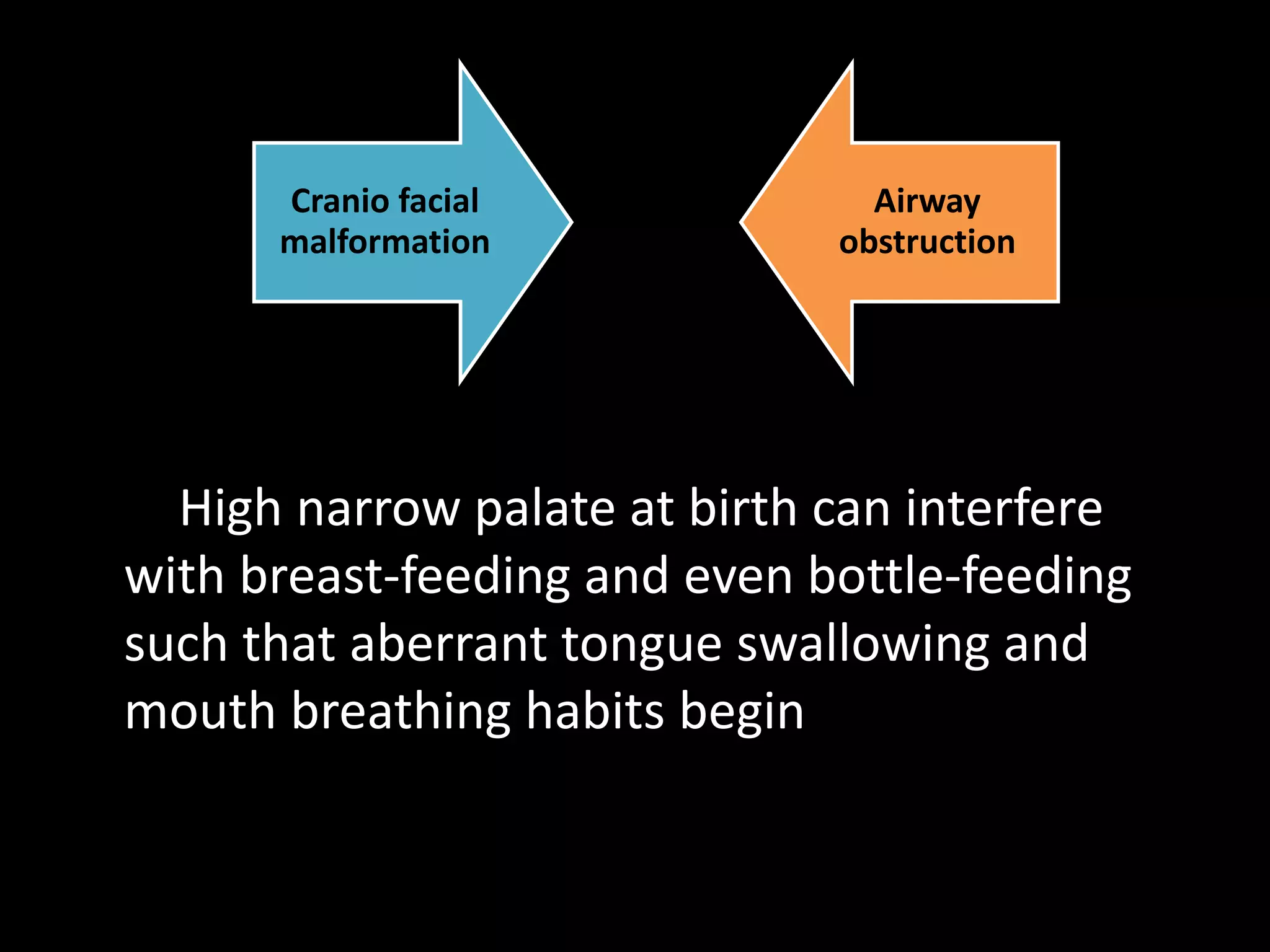 High narrow palate at birth can interfere
with breast-feeding and even bottle-feeding
such that aberrant tongue swallowing and
mouth breathing habits begin
Cranio facial
malformation
Airway
obstruction
 