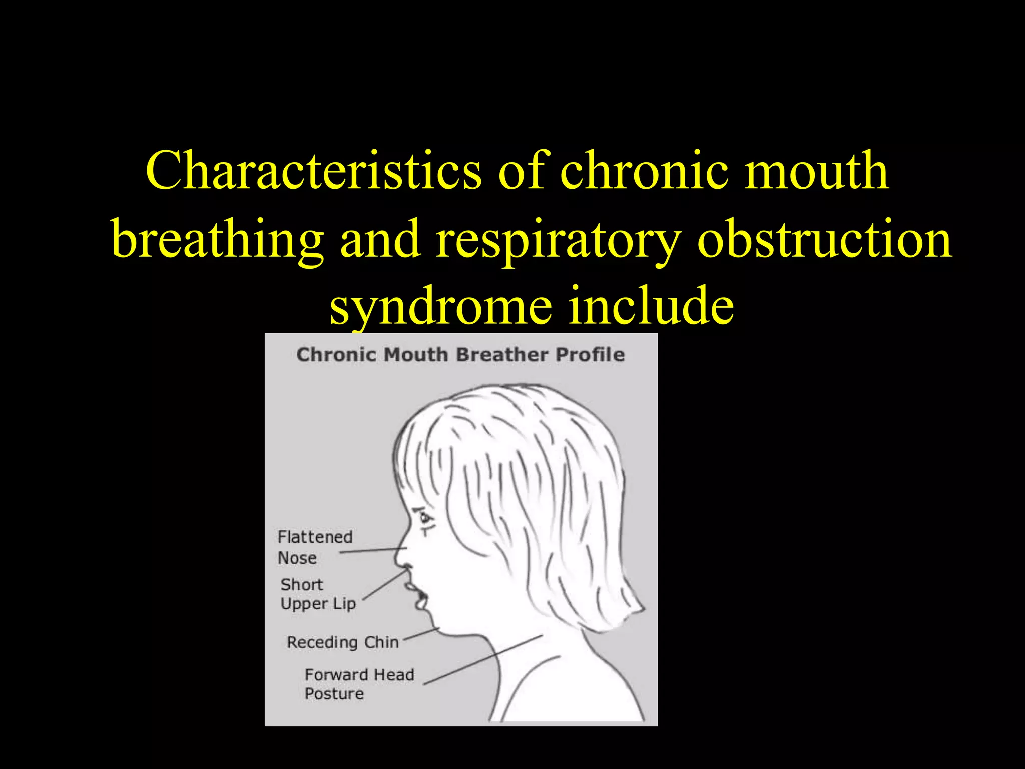 Characteristics of chronic mouth
breathing and respiratory obstruction
syndrome include
 