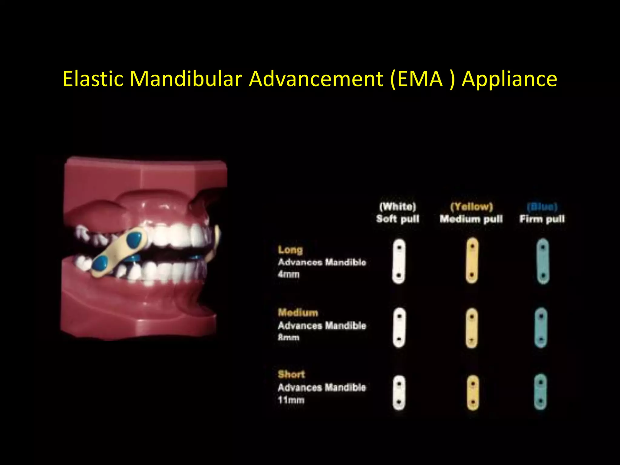 Elastic Mandibular Advancement (EMA ) Appliance
 