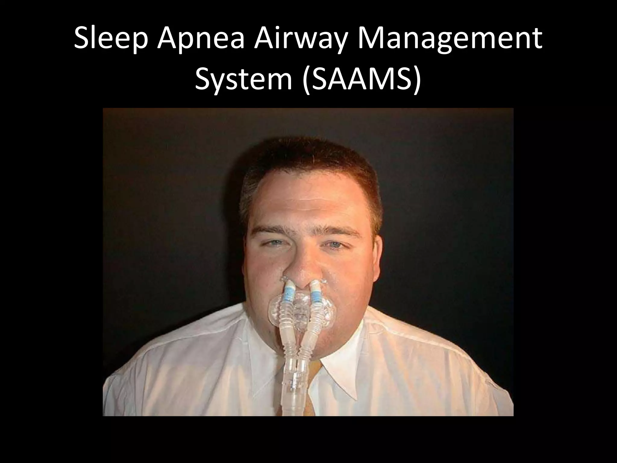 Sleep Apnea Airway Management
System (SAAMS)
 