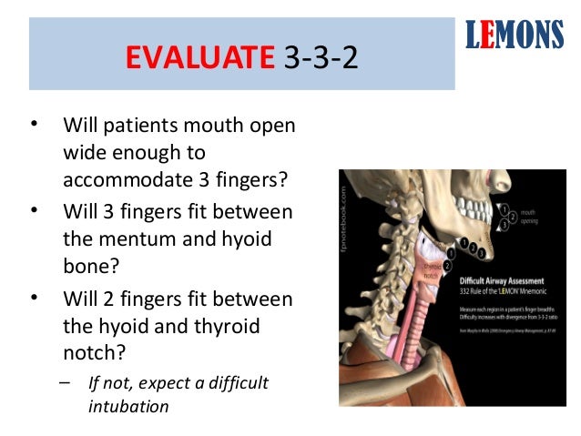 Upper Airway Assessment East Iv